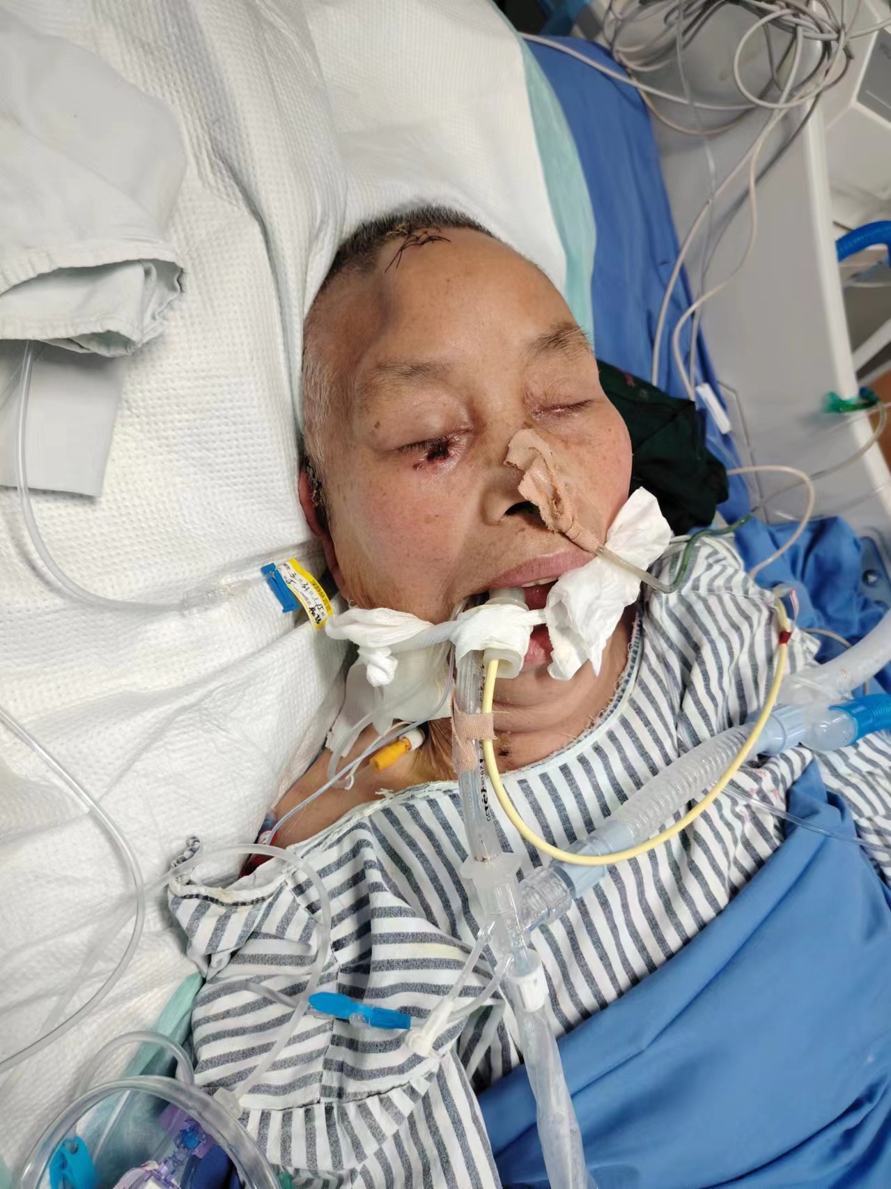 亚特兰大主帅尤里奇重病住院病情引发各界关注的简单介绍